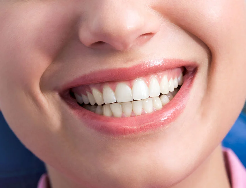 Gum-Contouring-reshaping