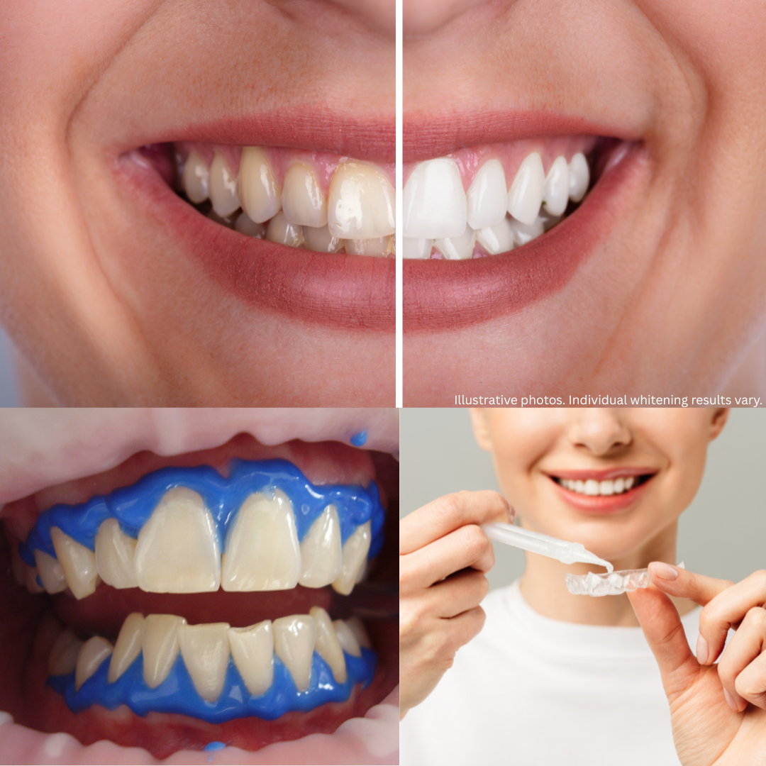Whitening Office and Home