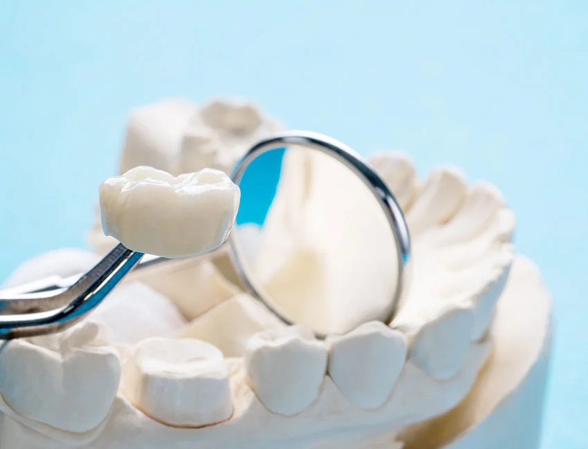 dental-crowns