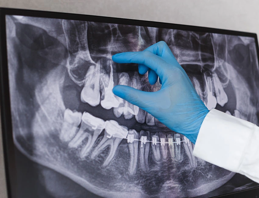 dental-x-ray