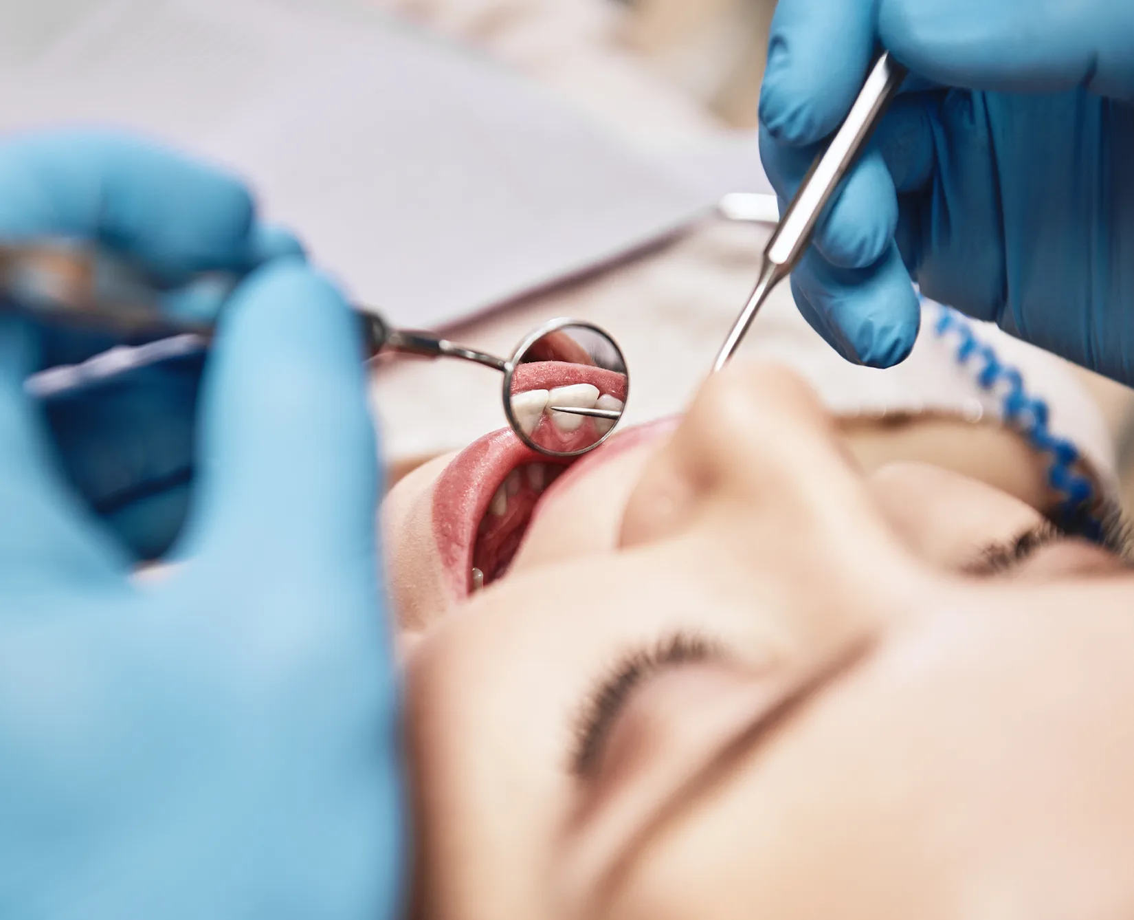 dentist-working-on-patient