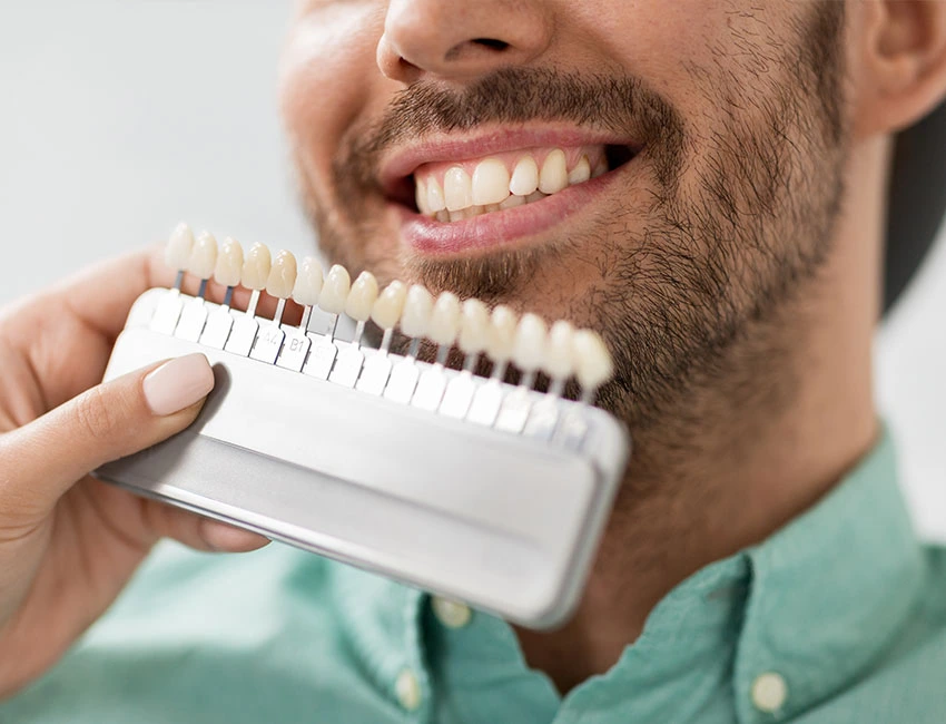 teeth-Whitening
